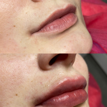 Юлія Чепурна, Полтава Фото - 8