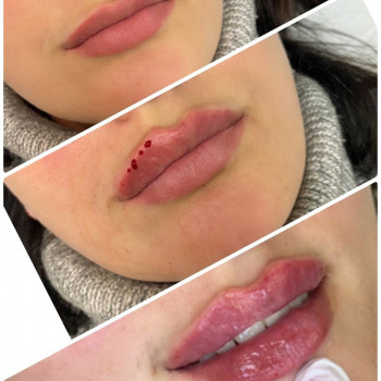 Контурная пластика губ
                    Мастер перманентного макияжа Юлия Лисицына Днепр