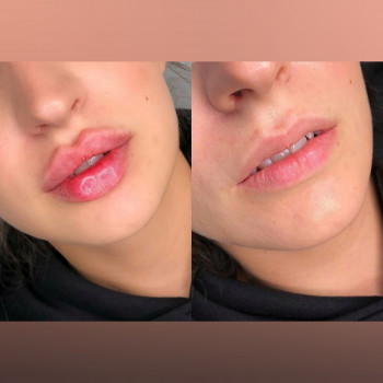 Контурная пластика губ
                    Мастер перманентного макияжа Юлия Лисицына Днепр