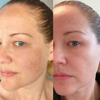 Kateryna Beauty, Одеса Фото - 9