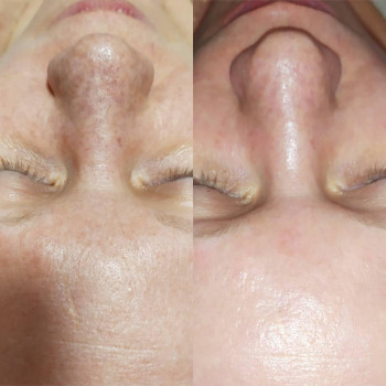 Светлана Хорькова, Николаев Фото - 33