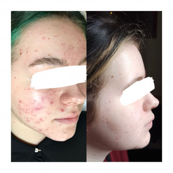 Евгения Ковалёва, Мариуполь Фото - 10