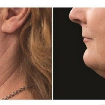 DR. RACHUK, Біла Церква Фото - 15