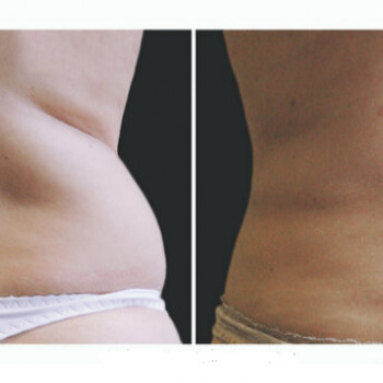 DR. RACHUK, Біла Церква Фото - 18