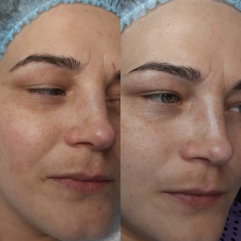 Алина Слома, Тернополь Фото - 26