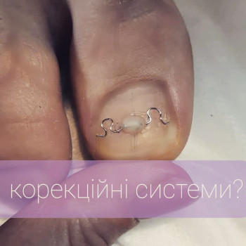 Що ж таке корекційні системи та для чого вони потрібні?