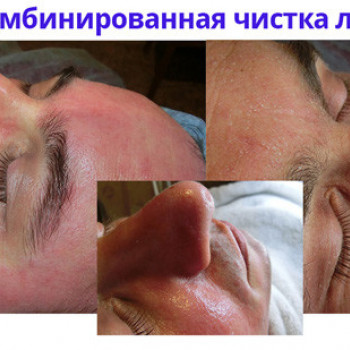 Юлия Гембержевская, Николаев Фото - 2