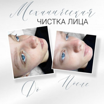 Фото з портфоліо косметолога Яна Новицька (Дніпро)