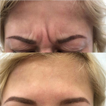 Ирина Булгар, Одесса Фото - 17