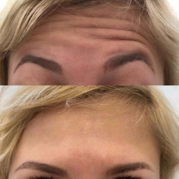 Ирина Булгар, Одесса Фото - 18