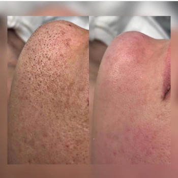 Ирина Булгар, Одесса Фото - 27