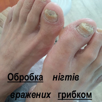 Vita Sana, Мукачево Фото - 10