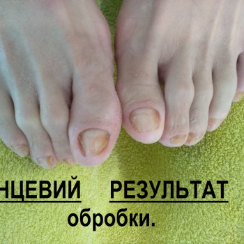 Vita Sana, Мукачево Фото - 11