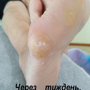 Vita Sana, Мукачево Фото - 14