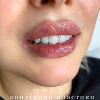 Bellissima, Миколаїв Фото - 50