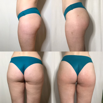 Юлия Турубарова, Мелітополь Фото - 17