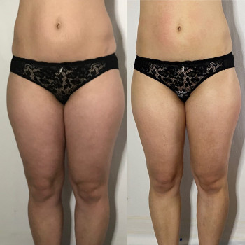 Юлия Турубарова, Мелітополь Фото - 19