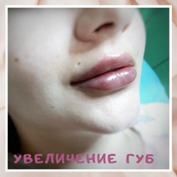 Марьяна Коломиец, Одесса Фото - 12