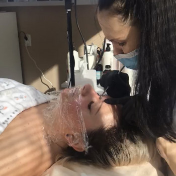 Механическая чистка лица