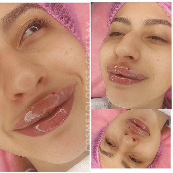 Наталья Грицай, Днепр Фото - 26