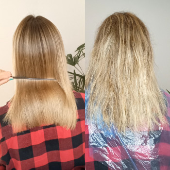 Разница После и До процедуры