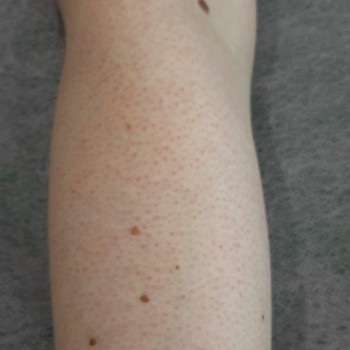 Алла Валіневич, Вінниця Фото - 8