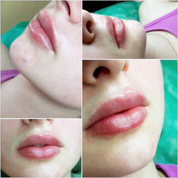 Бьютелль, Куп'янськ Фото - 6