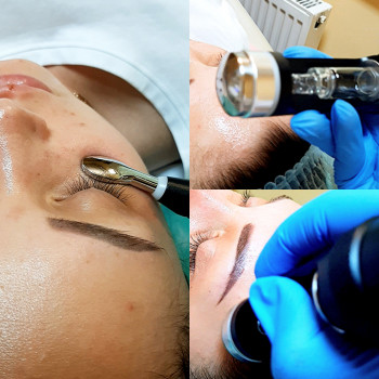 Бьютелль, Куп'янськ Фото - 7