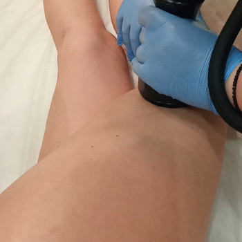 Вакуумный термомассаж ног
                    Массажист Виолетта Винникова Киев