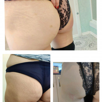 Вакуумный термомассаж
                    Массажист Виолетта Винникова Киев