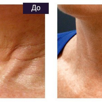 Алла Кириленко, Кропивницький Фото - 21