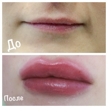 Увеличение сложных тонких губ