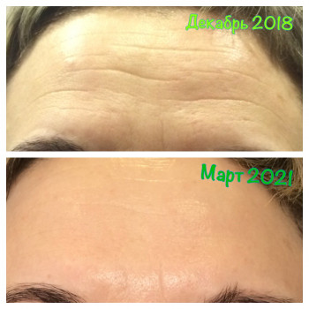 время идёт, а кожа выглядит с годами моложе))