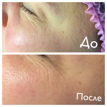 Увлажнение и уход