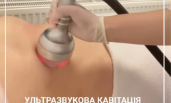 Ультрозвукова кавітація Косметологический центр Medicom Киев