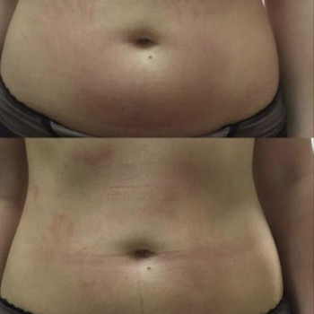 Алена Рыбкина, Днепр Фото - 28