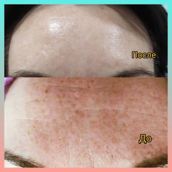 Алена Рыбкина, Днепр Фото - 33