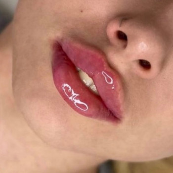 Алена Рыбкина, Днепр Фото - 34