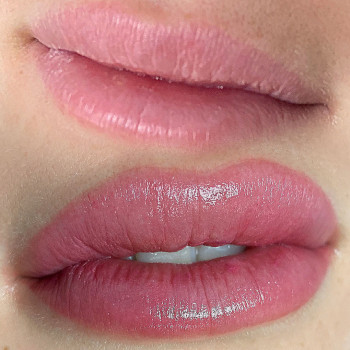 Lips