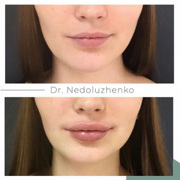 Ксенія Недолуженко, Ужгород Фото - 4