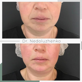 Ксенія Недолуженко, Ужгород Фото - 6