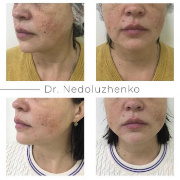 Ксенія Недолуженко, Ужгород Фото - 9