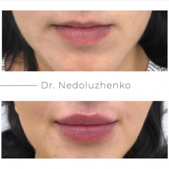 Ксенія Недолуженко, Ужгород Фото - 10