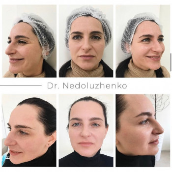 Ксенія Недолуженко, Ужгород Фото - 19