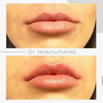 Ксенія Недолуженко, Ужгород Фото - 24