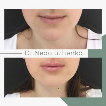 Ксенія Недолуженко, Ужгород Фото - 25