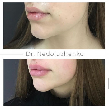 Ксенія Недолуженко, Ужгород Фото - 28