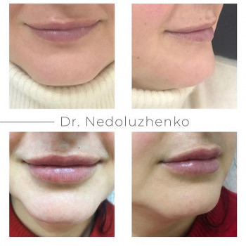 Ксенія Недолуженко, Ужгород Фото - 30