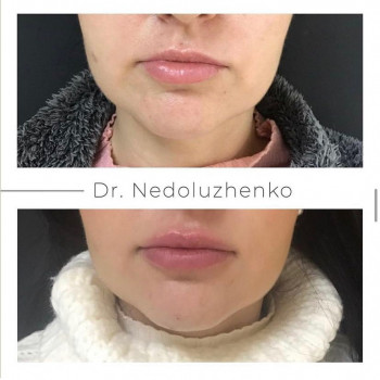 Ксенія Недолуженко, Ужгород Фото - 31