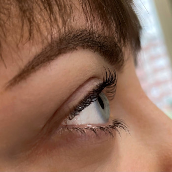 Ботокс ресниц.